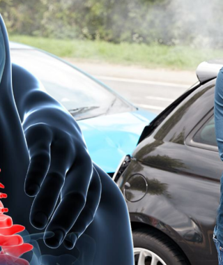 Strengthening Deep Neck Flexors: A Key Strategy in Whiplash Recovery