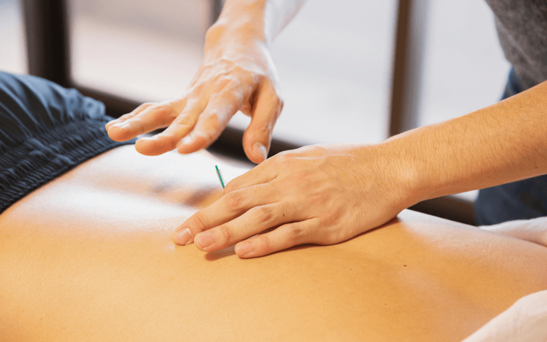 Acupuncture for Stress & Sleep: The Reset Your Body’s Been Asking For