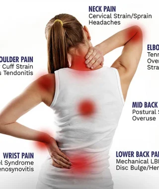 Understanding RSI: Causes, Symptoms, and Solutions